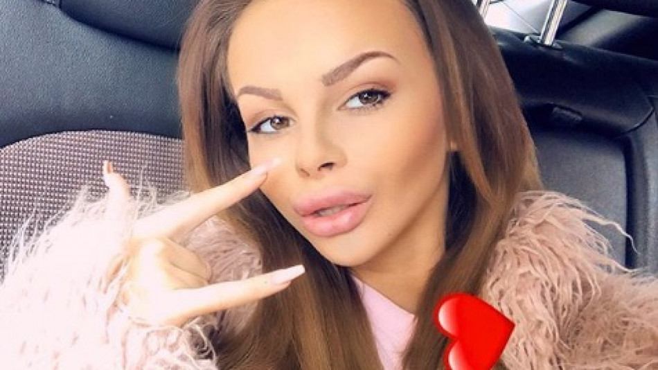 Сузанита отново легна под ножа! Оперира си носа!