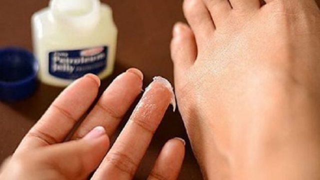 Ако страдате от сухи крака, задължително прочетете статията!