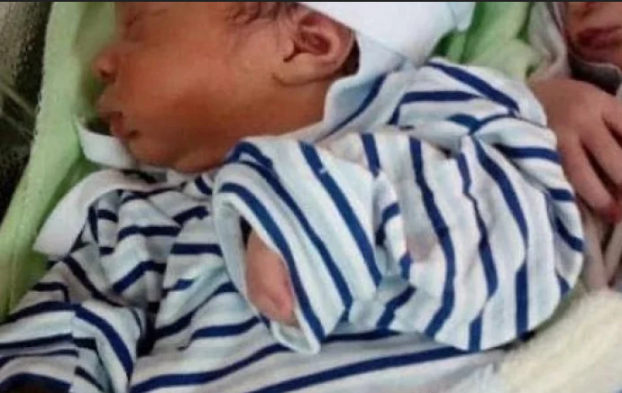 Жена роди близнаци, а лекарите и мъжът й онемяха, щом видяха бебетата СНИМКИ