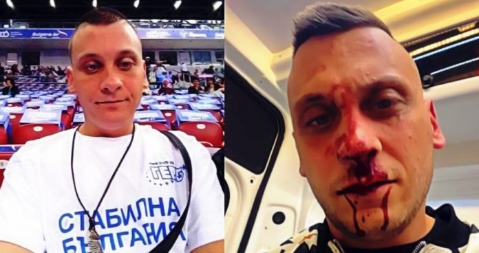 Битият Флоров: Беше ужасно, не спираха да удрят, псуват и ругаят