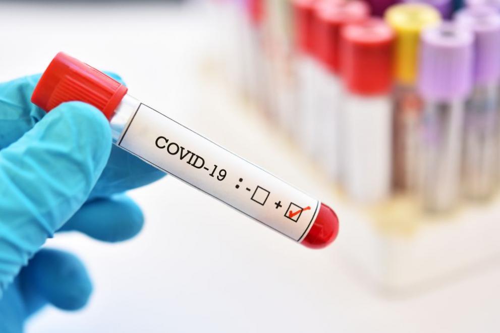 Канада се готви за Covid-21 – много по-заразен и смъртоносен